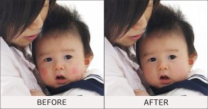 Baby-1-before-after