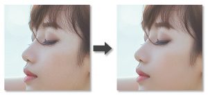 ノイズ補正-Before-After