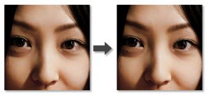 眼球補正-Before-After